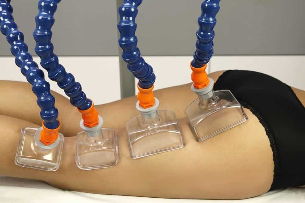 paciente en tratamiento physium system piernas